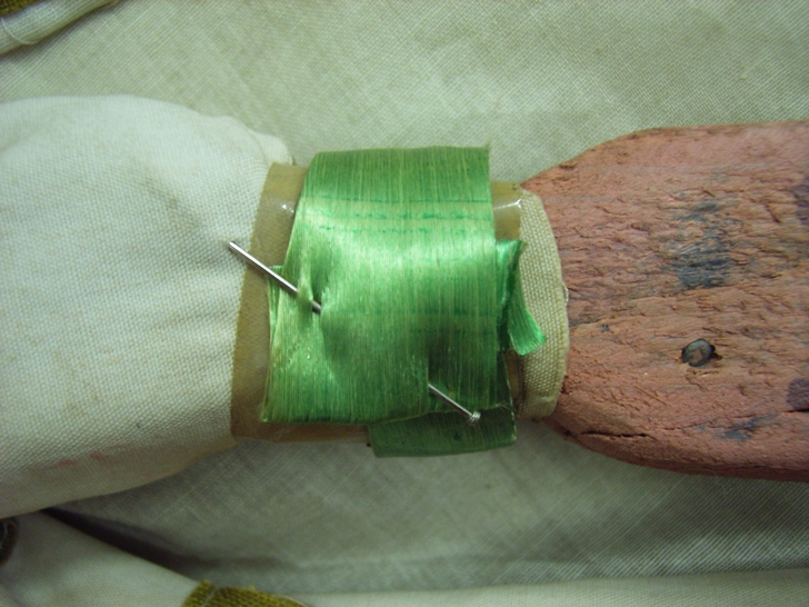 Polso sinistro prima del restauro